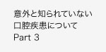 意外と知られていない口腔疾患について Part 3